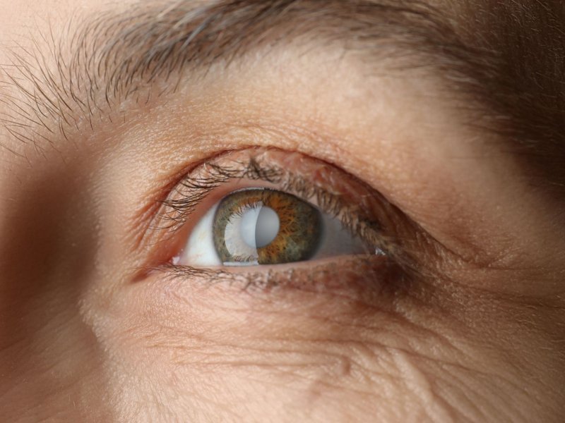 Gaziantep Katarakt Ameliyatı: Net Bir Görüşe Yeniden Kavuşmak