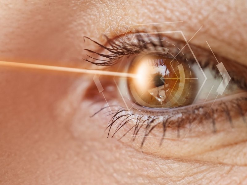 Gaziantep Lazer Göz Tedavileri: Modern Yaklaşımlar ve Güvenli Çözümler